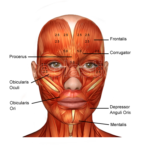 Facial muscles targeted by botulinum toxin — anatomy diagram
